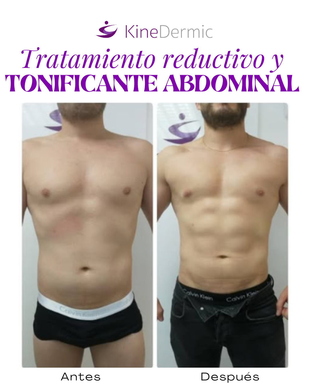testi abdomin